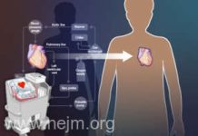 O nouă metodă de transplant ar putea extinde oferta de inimi provenite de la donatori